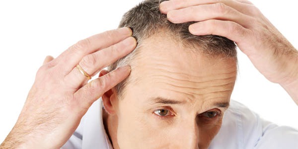 NeoGraft Hair Transplants Guide Part 3 – NeoGraft Vs FUT