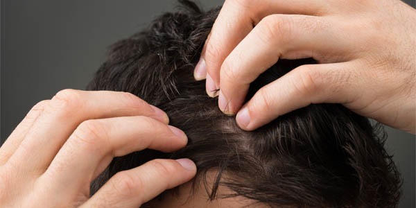 How NeoGraft hair transplants are performed