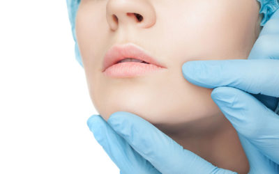 5 Benefits of the SkinPen System