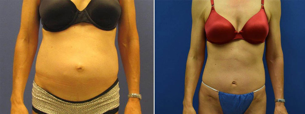 uumy-tuck-casestudy