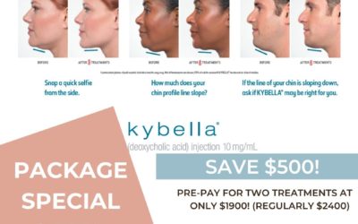 Save $500!