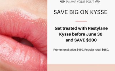 SAVE BIG ON KYSSE