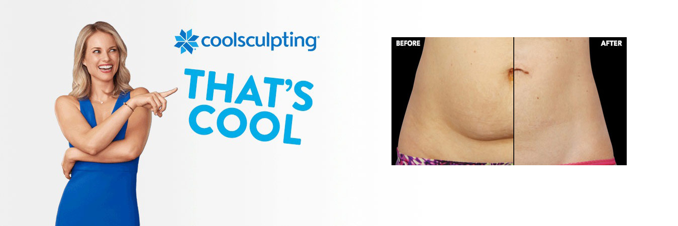 coolsculpting-cool