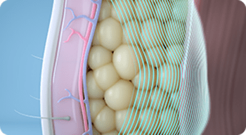 fat_cells-1